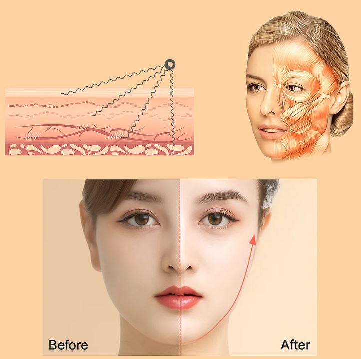 NomadeCare Rejuvenate – Électrodes TENS/EMS en tissu NomadeCare